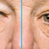 左側だけ太陽光を28年間浴び続けたトラック運転手、顔の左右で老化に大きな差が（米研